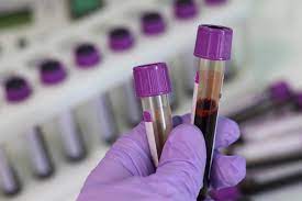 image service bloodtest by Waggin Tails Pet Care